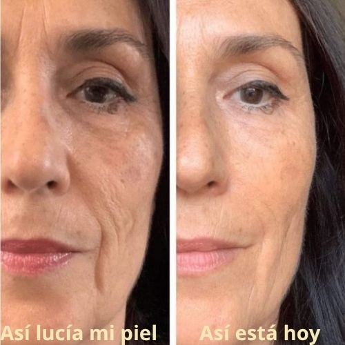 Resveratrol | El multivitamínico para lucir y sentirse más joven - 1 unidad x 400ml